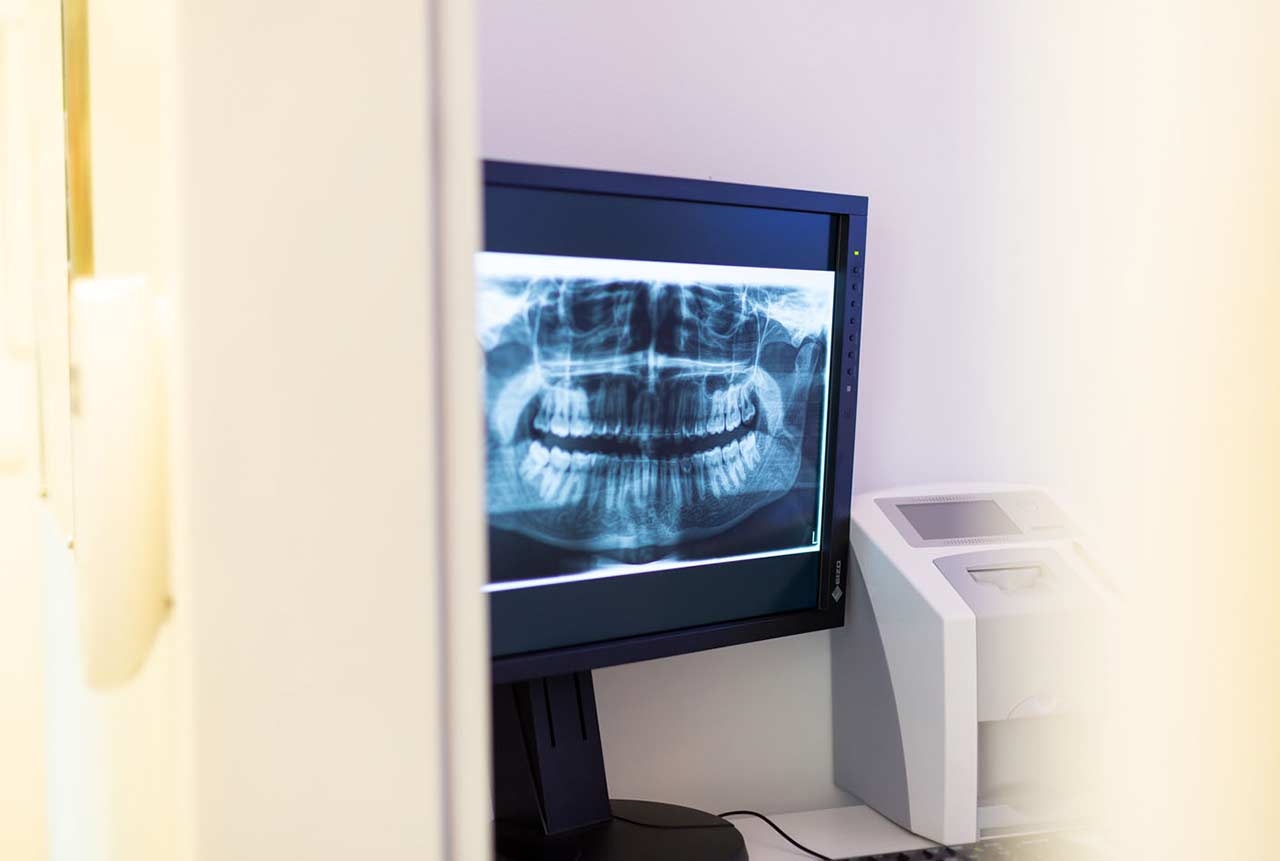 Ein Computermonitor in einem zahnärztlichen Praxisraum zeigt eine detaillierte Röntgenaufnahme eines Gebisses.